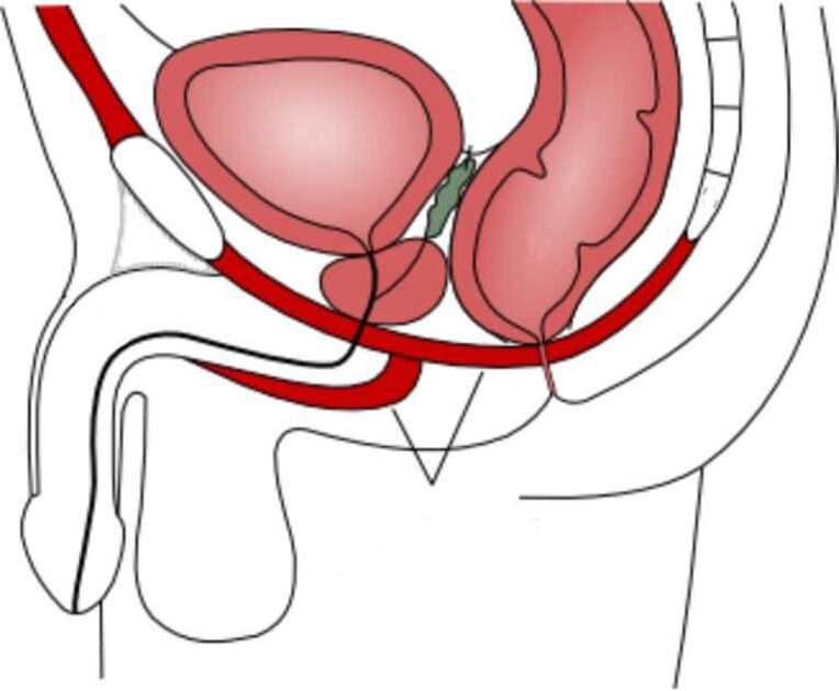 骨盤底筋をトレーニングして能力を向上させる